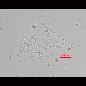 Cyanodictyon planctonicum