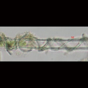 Leibleinia epiphytica